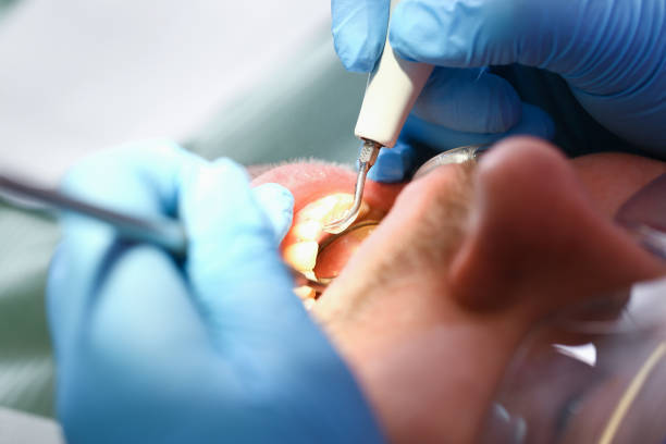 Best Tooth Infection Emergency Dentist  in Springfield, NE